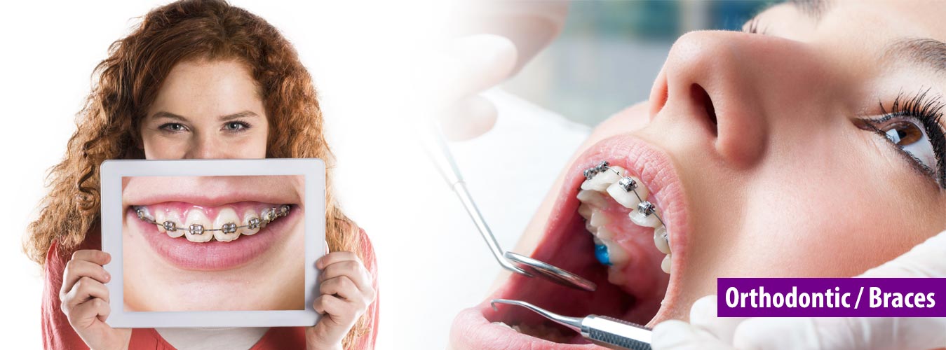 A woman smiling with dental braces while in background a dentist and a woman is interrogating, showcasing a beautiful bond and the importance of dental care.